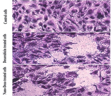 Cytotoxicity and Anticancer Effect of Chitosan-Ag NPs-Doxorubicin-Folic Acid Conjugate on Lungs Cell Line 