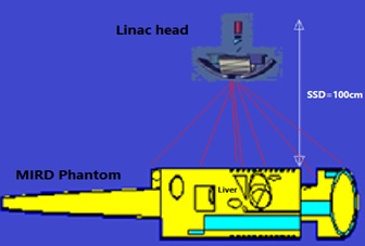 Radiation Hazards Investigation of Photon Scattering by Elekta 6 MeV Linac during Liver Cancer Treatment 